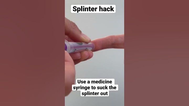 How to remove a splinter #shorts #splinter #splinterhack