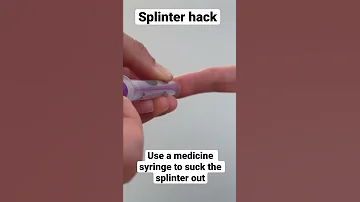 How To Remove A Splinter Shorts Splinter Splinterhack 