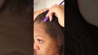 Lavish Curls Scalp Psoriasis treatment #naturalcurls #curlyhairproducts #haircare #scalppsoriasis