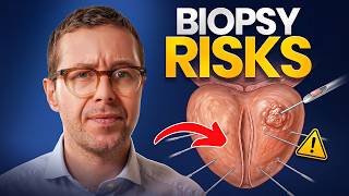 The Dark Side of Prostate Biopsies