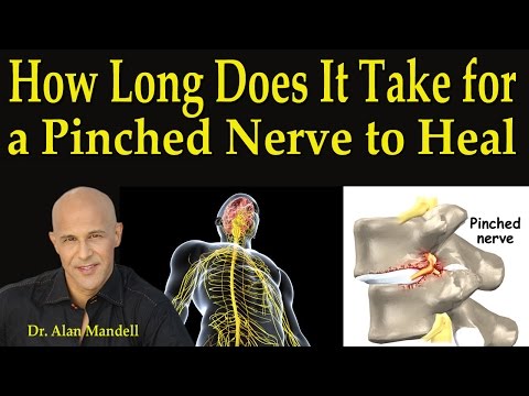 how-long-does-it-take-for-a-pinched-nerve-to-heal---dr-mandell