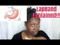 Lap Band Explained!!!||| My journey.