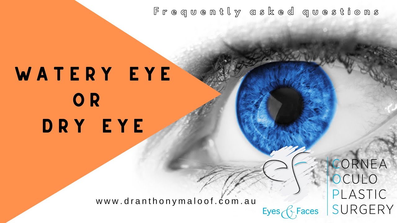 Watery or Dry Eye - One Step Real World Test - Dr Anthony Maloof, Sydney