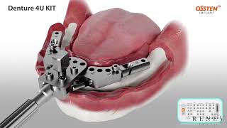 Denture 4U KIT