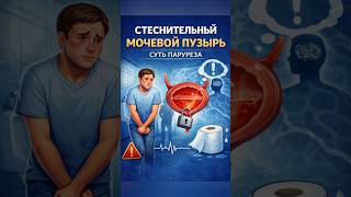 Стеснительный Мочевой Пузырь. Суть Паруреза.