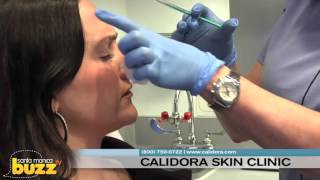 The Local Buzz 247 Features Calidora Skin Clinic Santa Monica