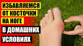 ЕСЛИ БОЛИТ ШИШКА НА НОГЕ ЧЕМ ЛЕЧИТЬ