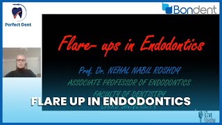 Flare up in Endodontics | Bondent | Prof. Nehal Nabil | Perfect Dent
