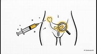 Can the O-Shot cause excessive sensitivity? | WHC Clinical FAQ