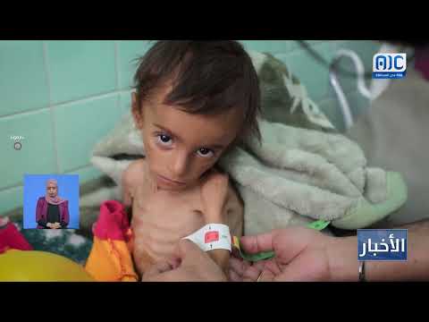 تقرير | تدهور صحي مخيف في مناطق سيطرة الحوثيين جرّاء نهب المساعدات الطبية