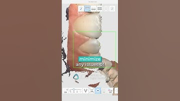 Essential Tips for Perfect Dental Scans with Medit