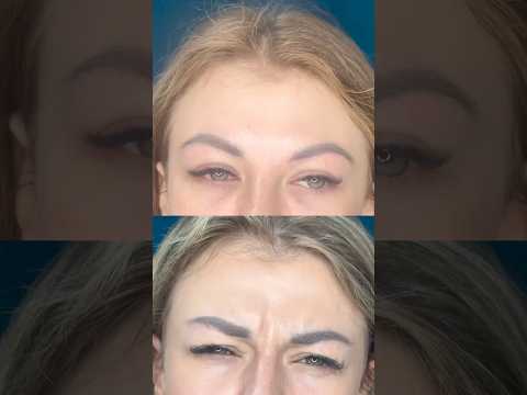 Как поднялись брови после этой процедуры 😍 #косметологростов #beforeandafter #лифтингмосква