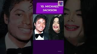 Famous 10 Plastic Surgery That Went Horribly Wrong #short Net Worth