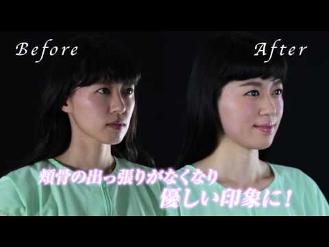 ゆがみを整えて 切らずに卵型の小顔美人へ Youtube ゆがみを整えて 切らずに卵型の小顔美人へ Youtube