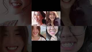 Which One Do You Have viralytshorts teeth forentertainmentpurposesonly viral aestheic