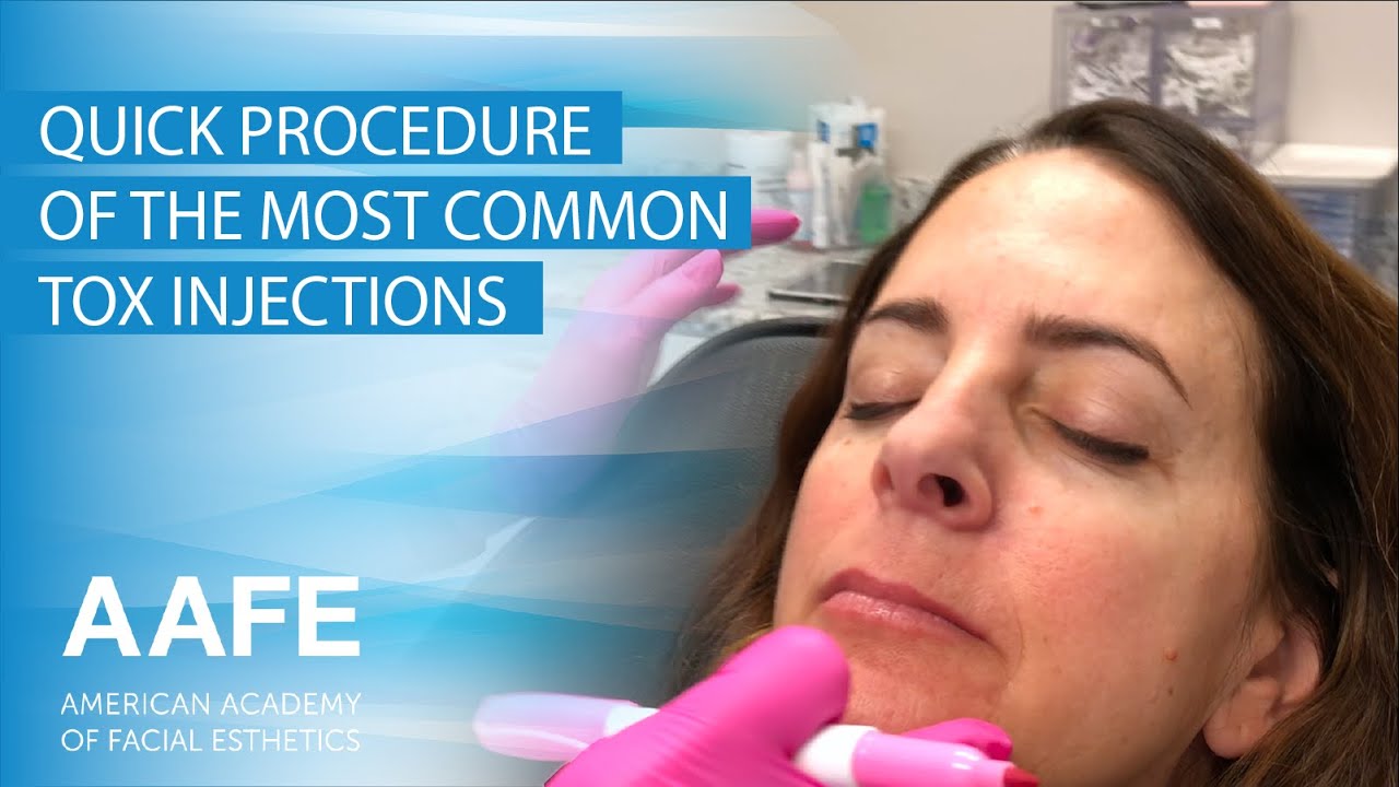 Quick Procedure Of The Most Common Tox Injections YouTube quick-procedure-of-the-most-common-tox-injections-youtube