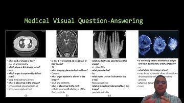 Multimodal Machine Learning in Healthcare: Concepts and Applications