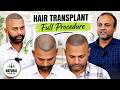 Hair Transplant in Ranchi (HX-QABH) | Best Results &amp; Cost of Hair Transplant in Ranchi