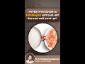 Himalayan Salt vs Table Salt for Hyperthyroidism. #HyperthyroidismTips #HimalayanSalt