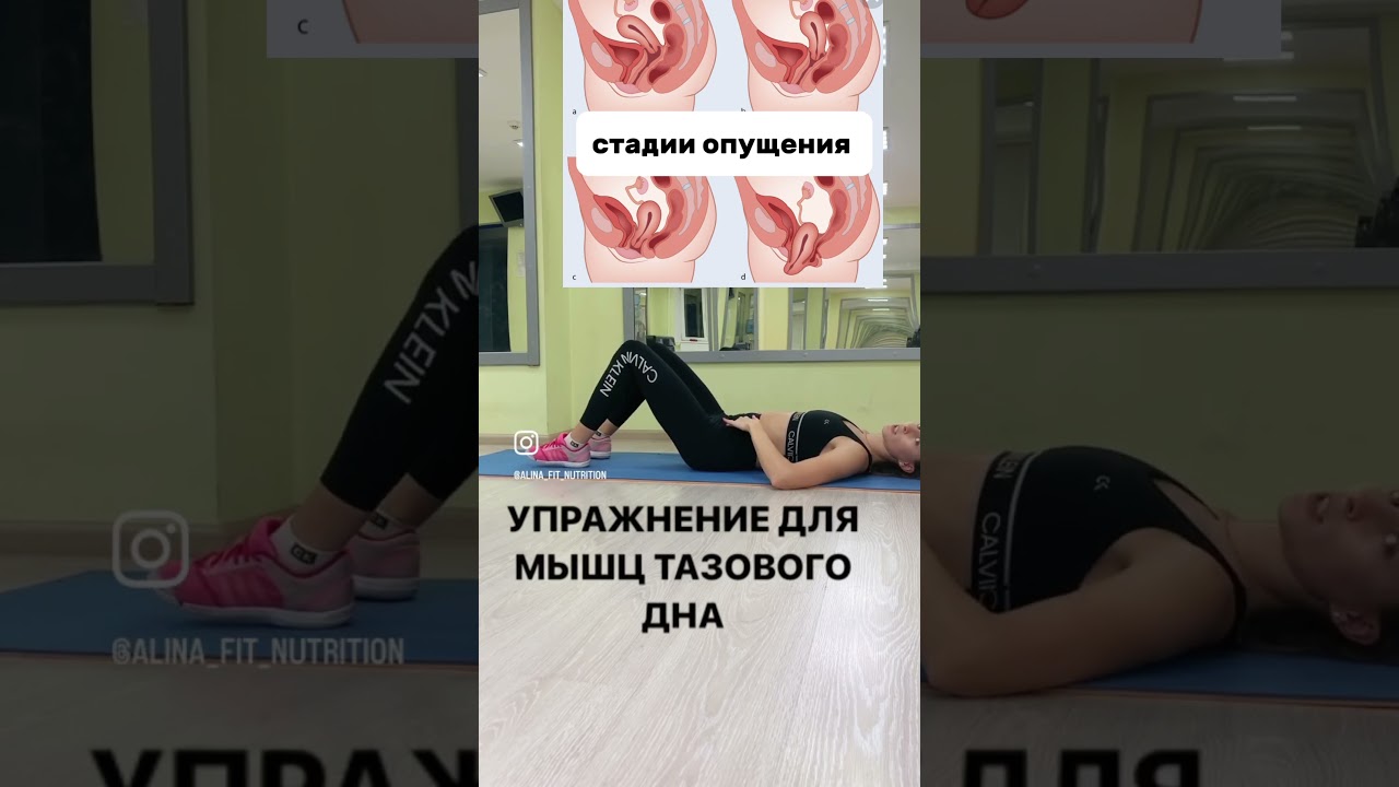 УКРЕПЛЯЕМ ЖЕНСКИЕ МЫШЦЫ ПРОТИВ ОПУЩЕНИЯ МАТКИ