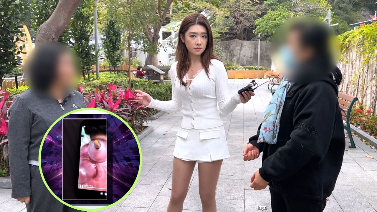 東張西望｜拔罐引致三叉神經痛索償被指踫瓷 當事人現身反擊，東張安排雙方對質各執一詞｜拔罐｜三叉神經痛｜踫瓷｜廖倬竩