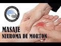 Neuroma de Morton tratamiento y fisioterapia