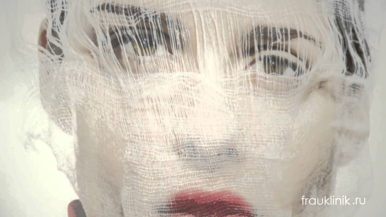 Лечение гипергидроза (повышенное потоотделение) - YouTube