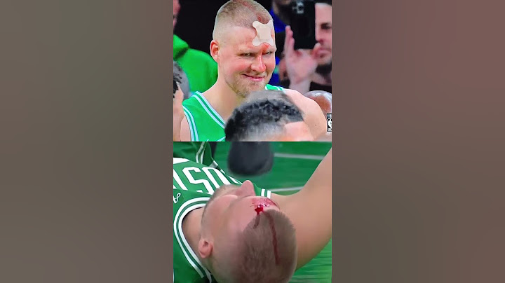Kristaps Porzingis Smiles Through the Pain after a BRUTAL Hit 😨