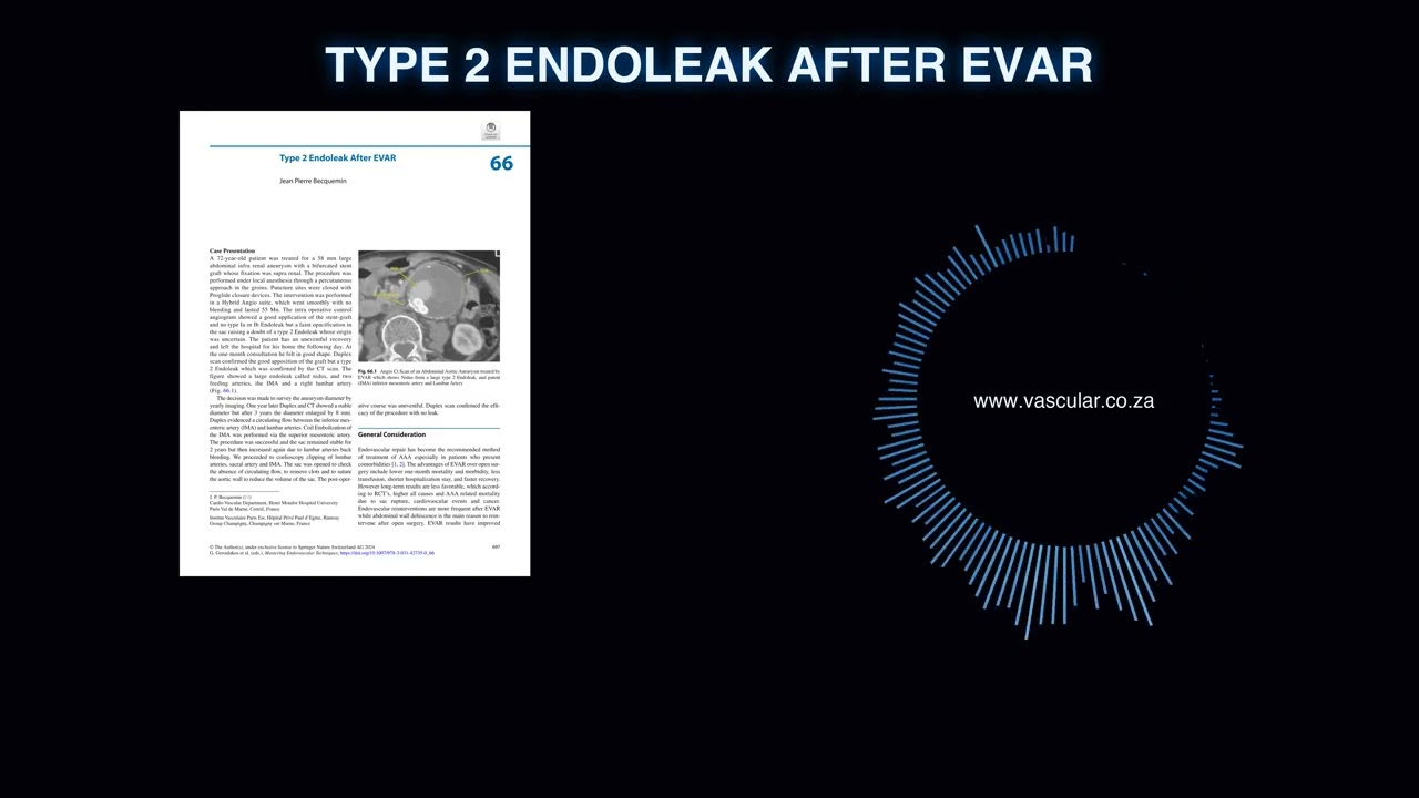 MET - 66 - Type 2 Endoleak After EVAR - Deep Dive Podcast