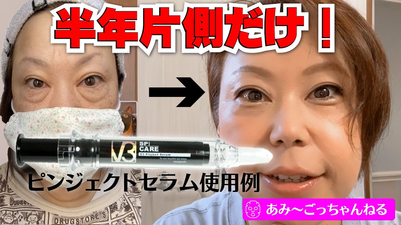 Skin Care for People in Their 50s] Shocking Results! Taking on