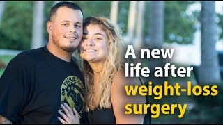 Alex and Josh: Life after weight-loss surgery