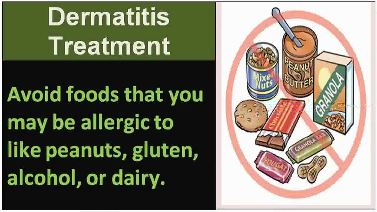 See cat dermatitis home treatment Tips for all! YouTube