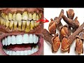        yellow teeth to white teeth tips  cavity tip