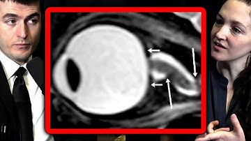 Why humans need gravity | Ariel Ekblaw and Lex Fridman