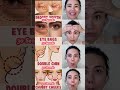 Slim Face, Double Chin, Eye Bag and Droopy Mouth #faceyoga #facelift #yoga #beautytips #exercise #yt