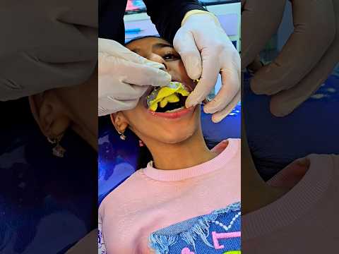 رودي عند دكتور الاسنان الفيديو كامل هنا