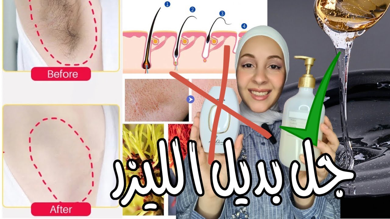الشعر هيختفي من جسمك للأبد | جل ازالة الشعر