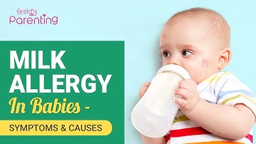 Milk Allergy in Babies - Causes and Signs