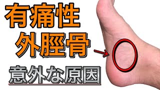 【有痛性外脛骨】「なんか足が痛い…」運動中の痛みが気になる人に　【原因　改善方法】