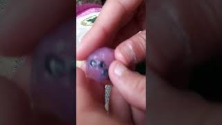 Un Ballon Avait Pills On Va Les Retiré