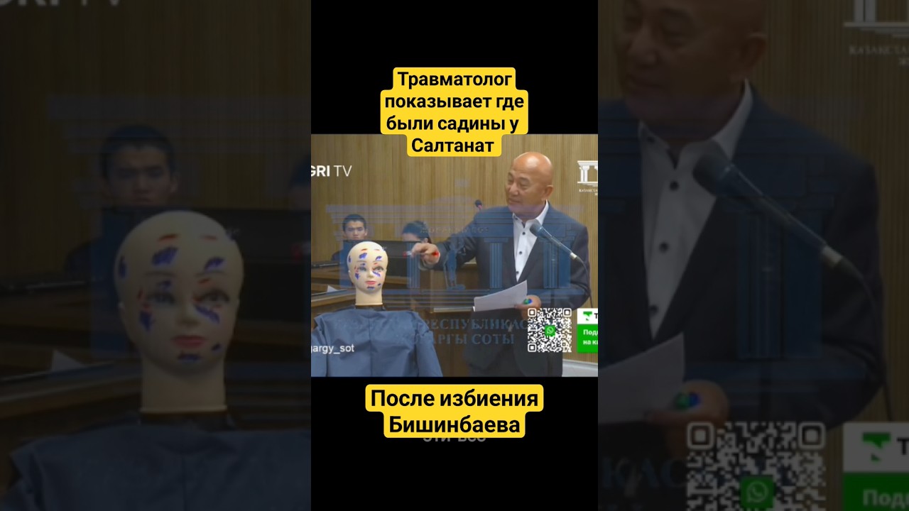 Травматолог показывает где были садины у Салтанат 