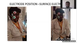 electrooculogram (EOG) -BIOMEDICAL INSTRUMENTATION