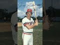 MLB PLAYERS WHO HAD DISABILITIES BUT STILL MADE IT