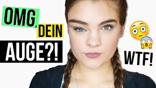 WAS IST MIT DEINEM AUGE?! ◆ Alles über meine Krankheit // I'mJette