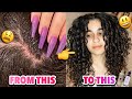 HOW TO HEAL, TREAT, & DEAL WITH DRY, ITCHY, FLAKY, & IRRITATED SCALP! || Curly Hair Scalp Health