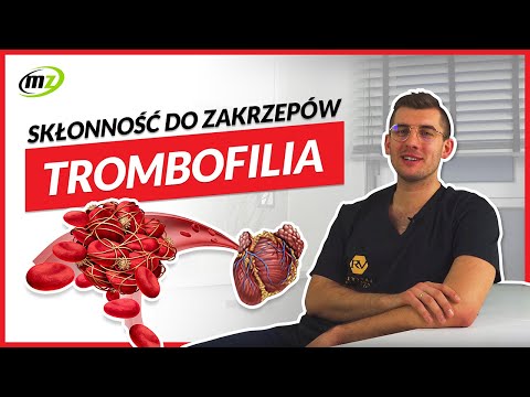 Wideo: Trombofilia: Dziedziczna, Objawy, Badanie Przesiewowe, Leczenie, Przyczyna