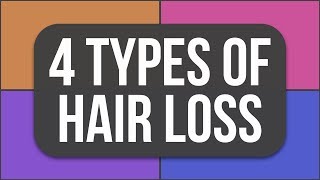 What Type Of Hair Loss Are You Experiencing???
