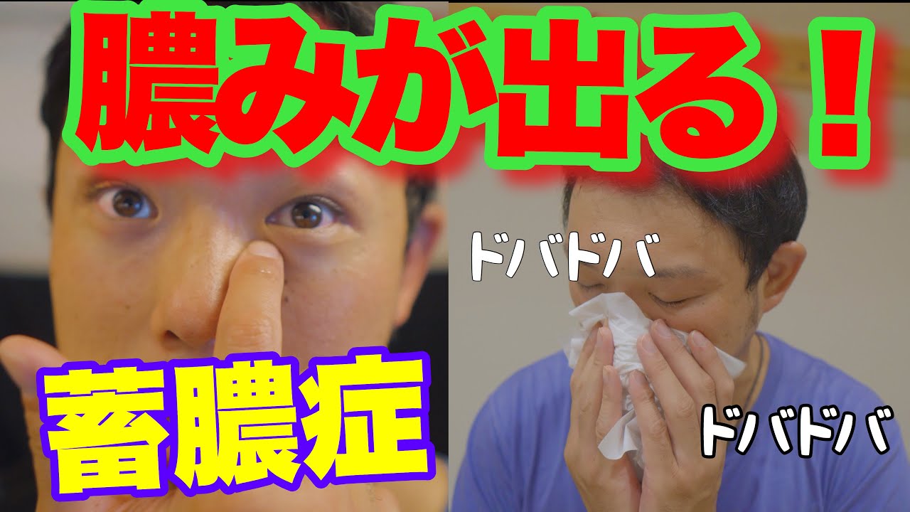 慢性的な蓄膿症でお悩みの方へ 日常的に膿みを出してスッキリできる方法知りたくないですか Youtube