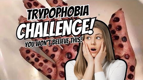 TRYPOPHOBIA TEST - Do YOU Fear Small Holes?