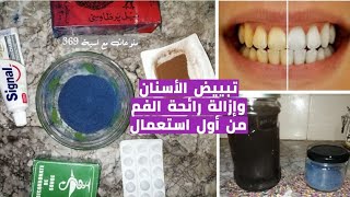 خلطة لتبييض الاسنان من أول استخدام، غسول فم آمن لعلاج مشكل اللثه و إزالة رائحة الفم من أول استعمال